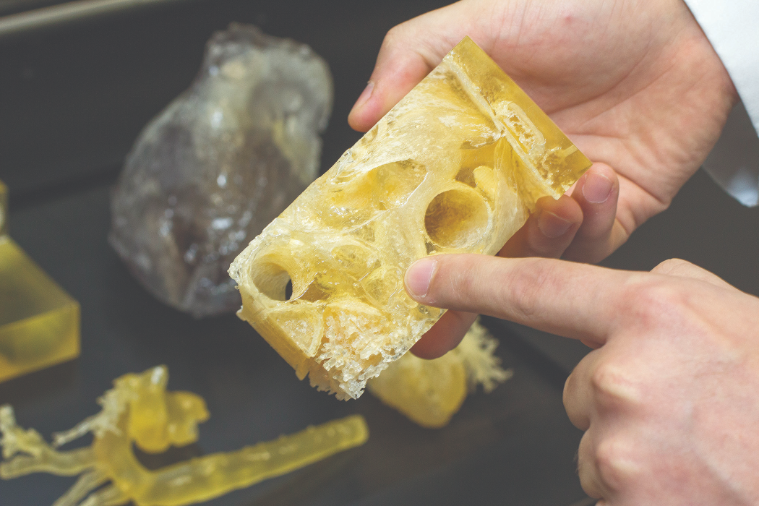 3D printed models are used to assess surgery risks to patients.