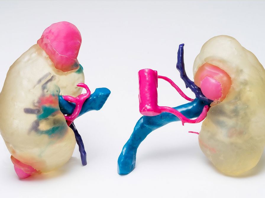 With Connex3, doctors at Asan Medical Center can
print organ models that are both soft and transparent.