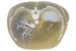 Stratasys Announces Radiopaque Material For Digital Anatomy 3D Printer