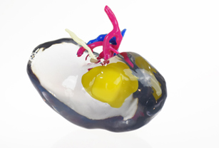 3d printed medical models