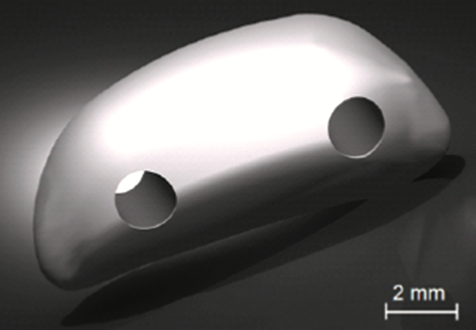 CAD model of patella.