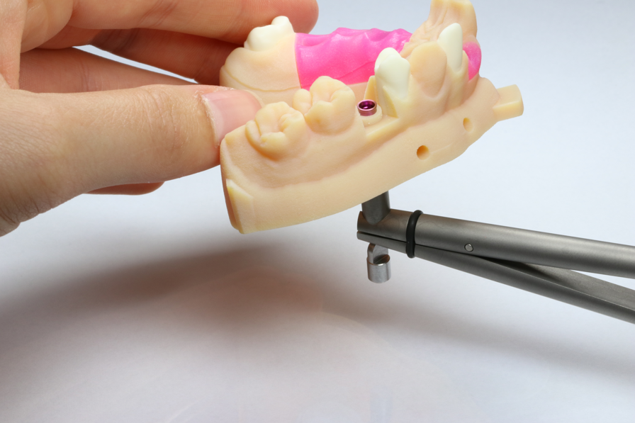 Elos Accurate Analogs Helps Innovate 3D Printed Models for Dental Labs