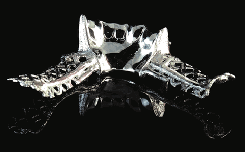 Las piezas acabadas, como esta prótesis de aleación pulida, son más precisas cuando se utiliza el método digital.