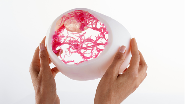3d printing medical model