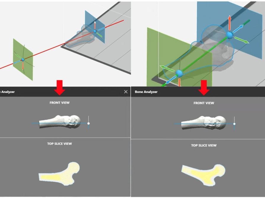J750 Digital Anatomy screen capture with bone figure.