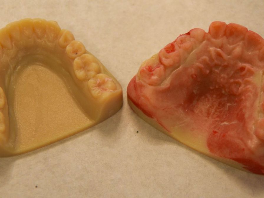 Improving 3D Printed Dental Solutions with NEO Lab