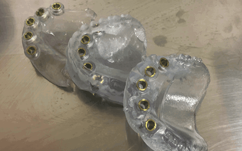 Guías quirúrgicas de arcada completa impresas en MED610.