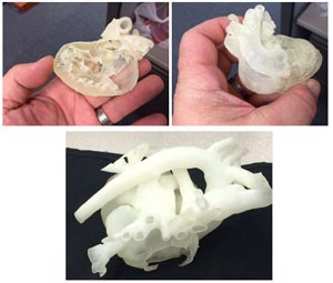 3d printed pediatric heart models