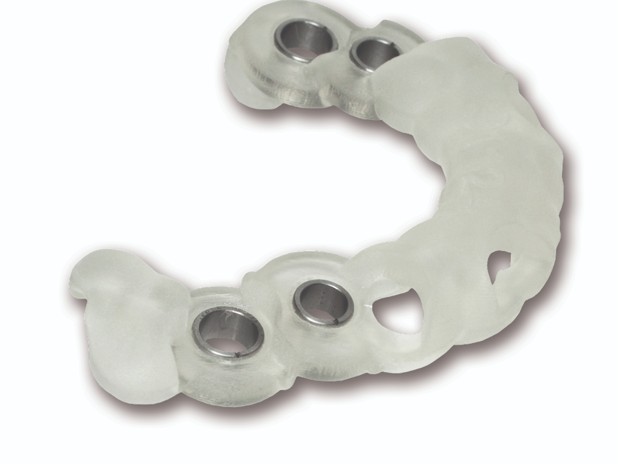 A 3D printed surgical guide used for precise location of dental
implants in MED610 material.