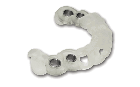 Guía quirúrgica impresa en 3D utilizada para la ubicación precisa de implantes dentales en material MED610TM.