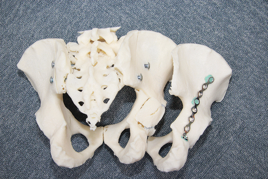 anterior view of 3d printed tailbone
