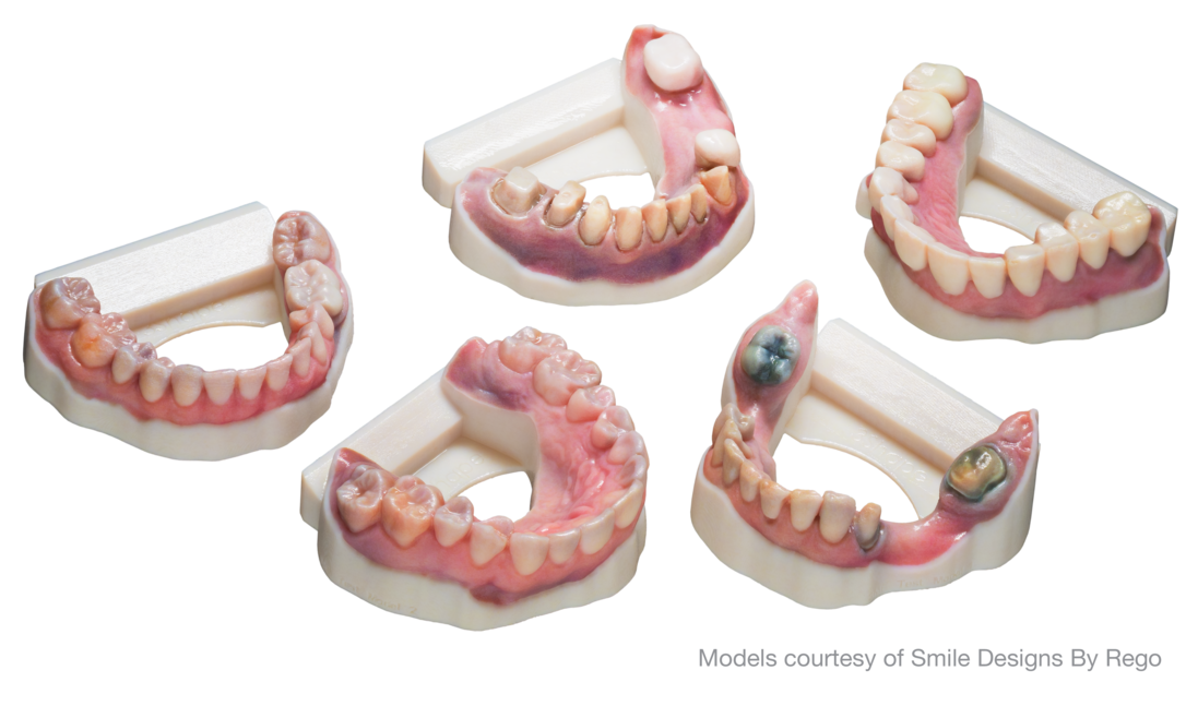 Stratasys and 3Shape introduce new automated digital color workflow for ...