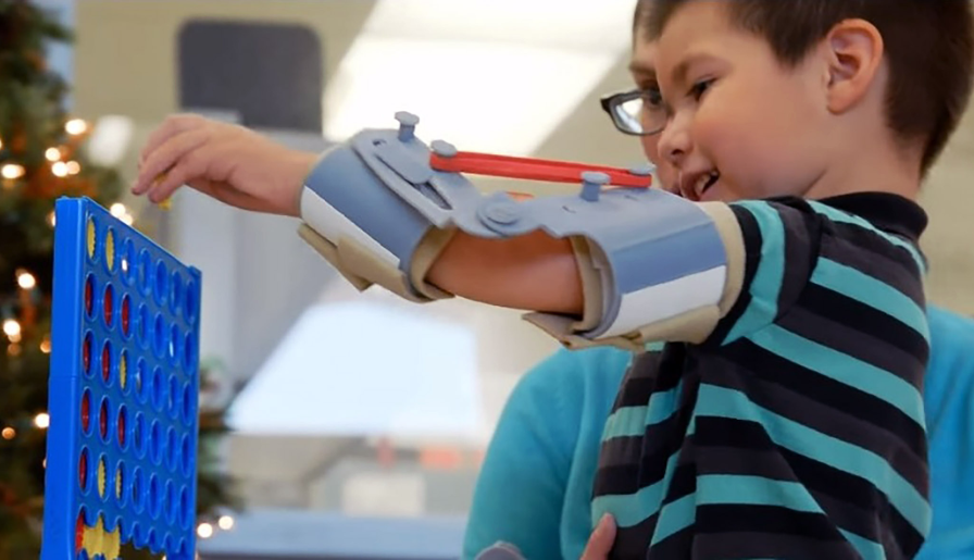 Despite having arthrogryposis, Noel can bend his arms and play more using his custom 3D printed exoskeleton arms.