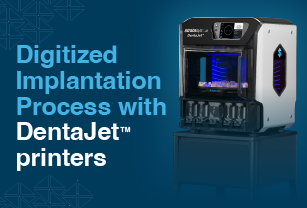 Digitizes Implantation Process
