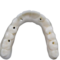 KeyDenture Try-In