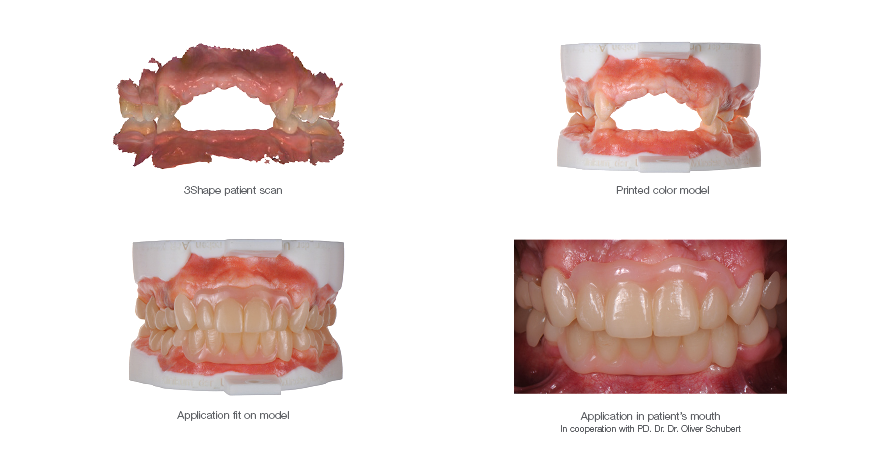 scanned teeth and 3d printed teeth full color.png