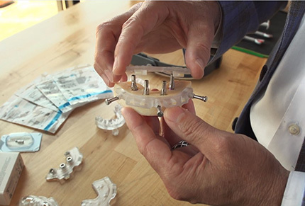 Implant concierge Guide