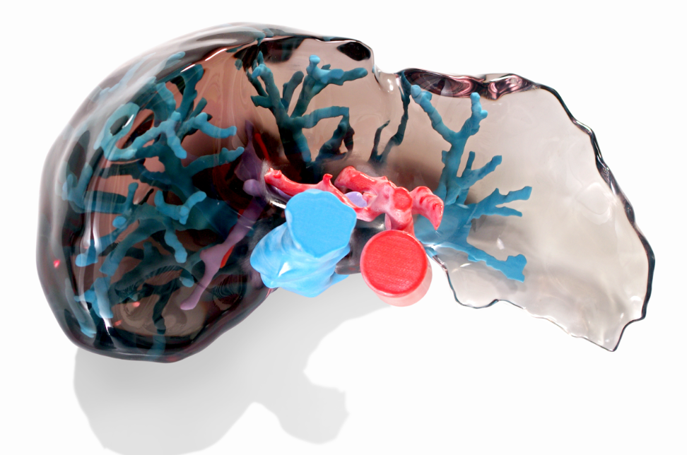 3d Printed Liver