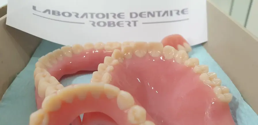 truedent-dentures-at-laboratoire-robert