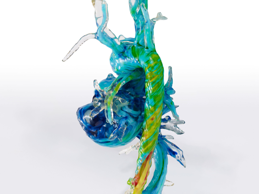 <div>Visual model created using hemodynamic data combined with patient&nbsp;<span style="letter-spacing: -0.03em;">anatomy to show blood flow. This model helped the medical team understand areas&nbsp;</span><span style="letter-spacing: -0.03em;">of the heart that they could access without disrupting blood flow.</span></div>