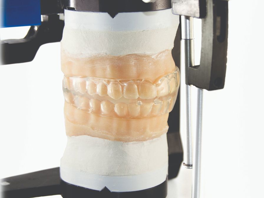 3D printed models like this articulator help reduce the number of appointments and appointment lengths.