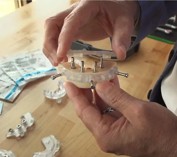 Implant concierge Guide