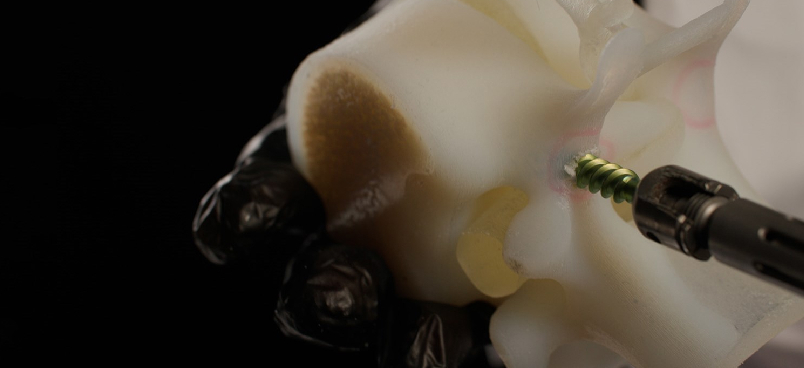 Explore the World of Orthopedic Applications in 3D Printing