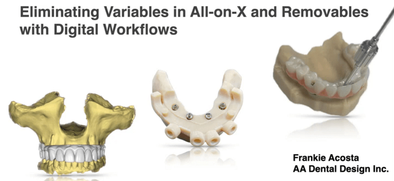 Eliminating Variables in All on X and Removables with Digital Workflows