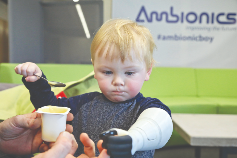 With DAHB technology, Sol is able to manually operate his prosthetic arm or get assistive power from a motorized pump.