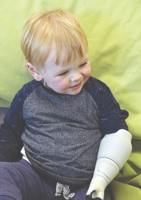 Child pictured with 3D printed arm. 