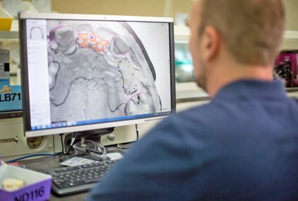 dental lab productivity solution guide