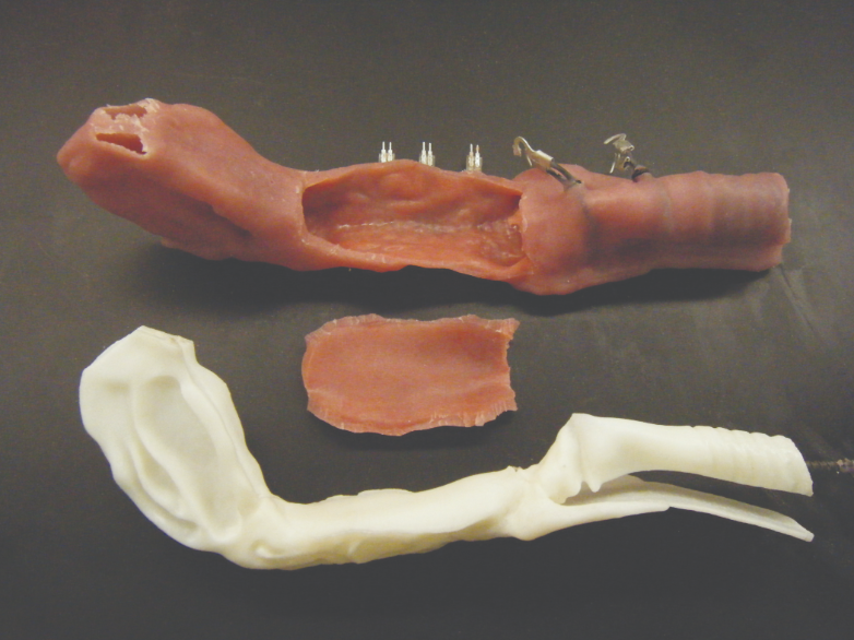 3D printed components were used in a prototype
airway trainer.