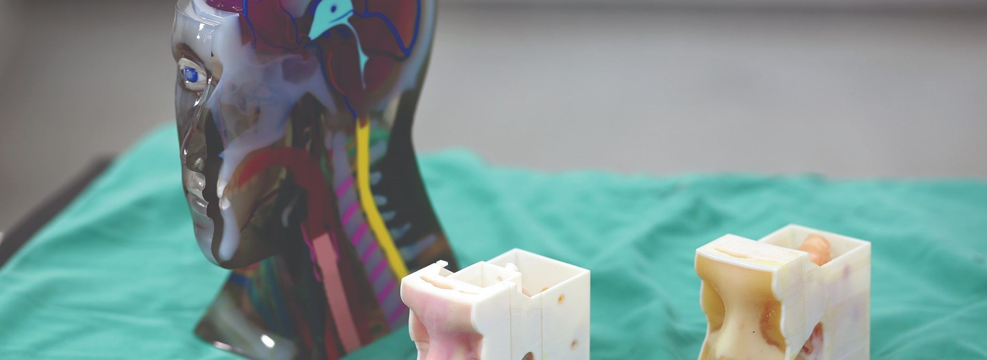 3D printed patient-specific models for surgical planning.