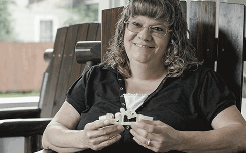 Teresa Flint sostiene un modelo de su aneurisma cerebral impreso en 3D.