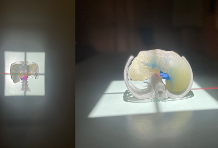 3D Print liver model in xray