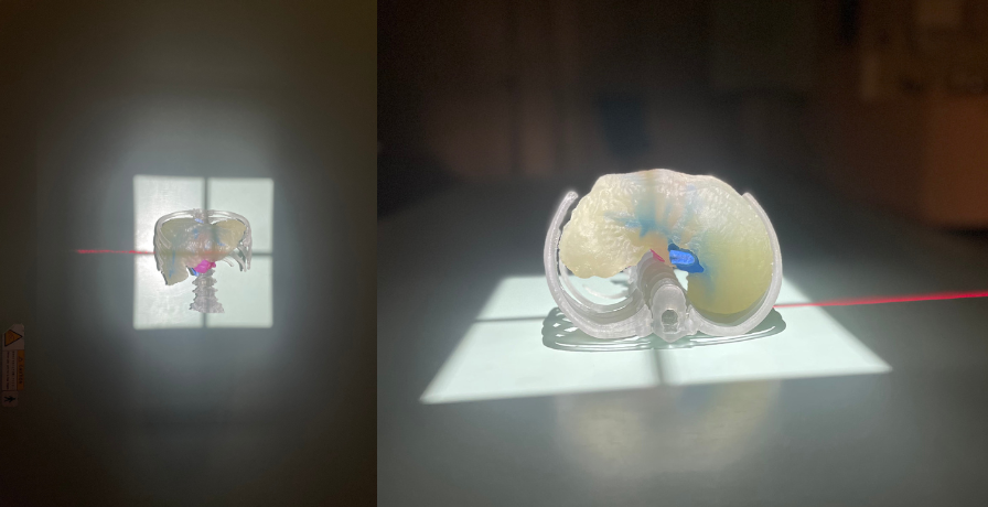 3D Print liver model in X-Ray