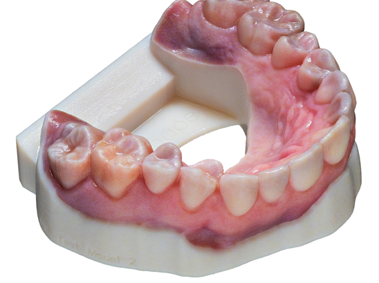 Color dental model