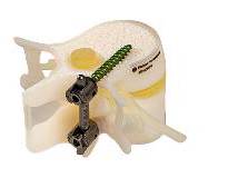 bone-matrix-3d-printing-material