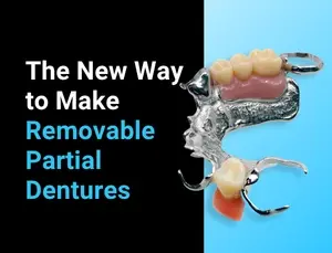 Digital Removable Partial Dentures Webinar | TrueSnap Workflow