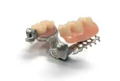 removable-partial-denture