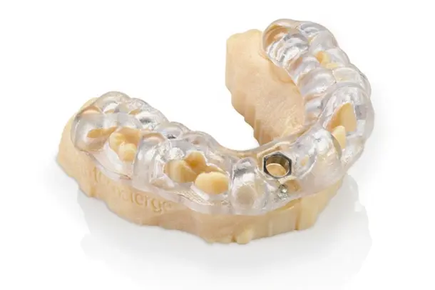 surgical-guide-on-dental-model