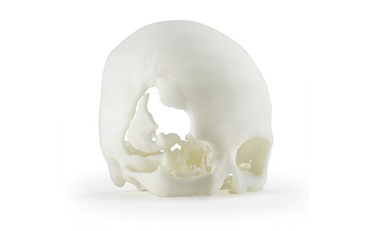 ABS-M30i: A Biocompatible Thermoplastic Material