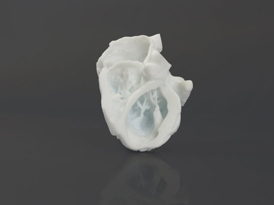 3D printed human heart using MED Silicone 25A