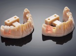 image gallery dental materials dental prototype natural2