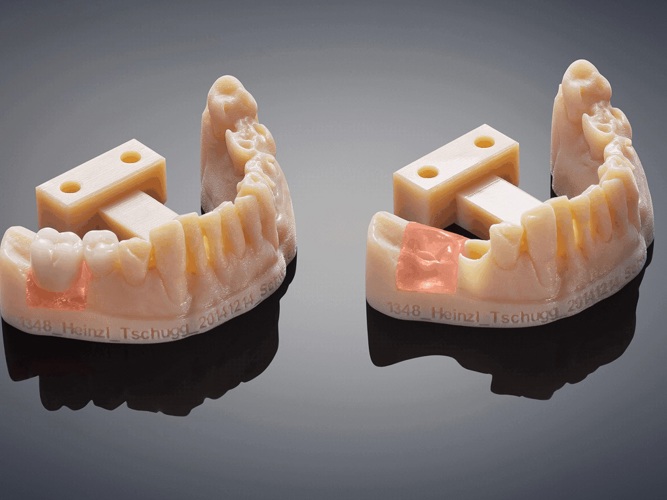 image gallery dental materials dental prototype natural2