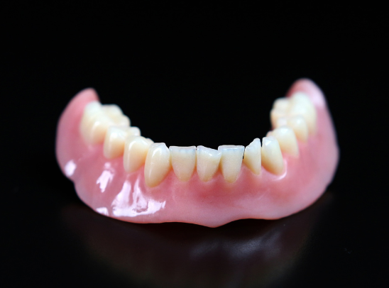 3D printed TrueDent Lower Denture by Lino Adolf.
