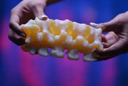 3D printed anatomical orthopedic model