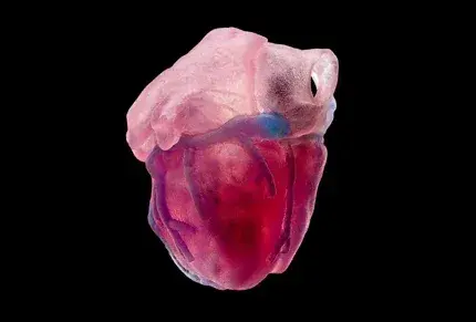 3D printed heart for cardiac surgery