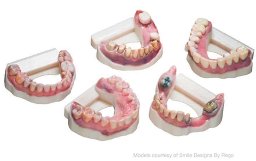 New color workflow with 3Shape Dental System®
