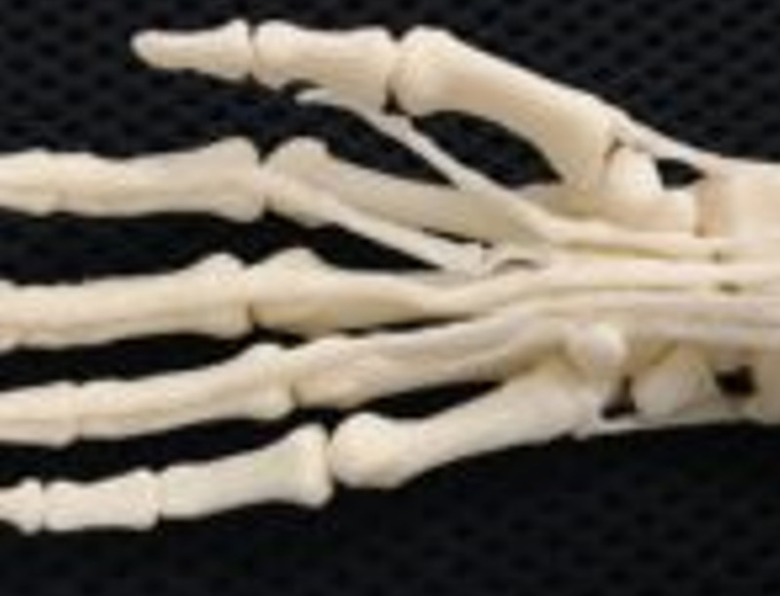 3D printed hand skeleton model 2